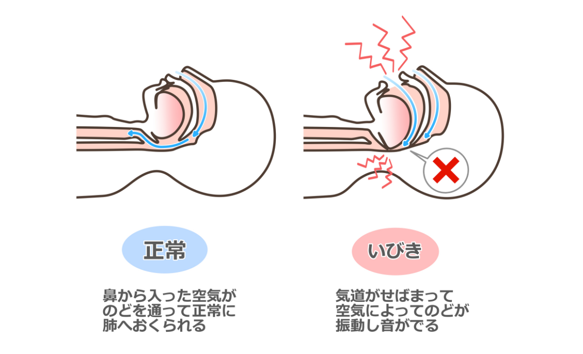 眠る時に楽な姿勢を知る